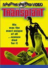 Фильмография Жуан Фернандис - лучший фильм The Amazing Transplant.